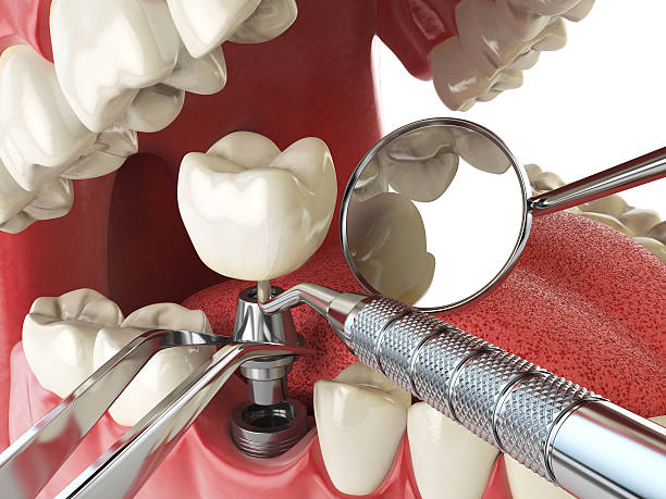 Best Urgent Care for Lost Fillings or Crowns in Sutton, NE